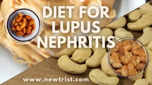 Diet For Lupus Nephritis