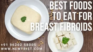 Best foods to eat for breast fibroids