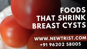 Foods That Shrink Breast Cysts