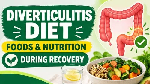 Foods and Nutrition During Recovery from Diverticulitis